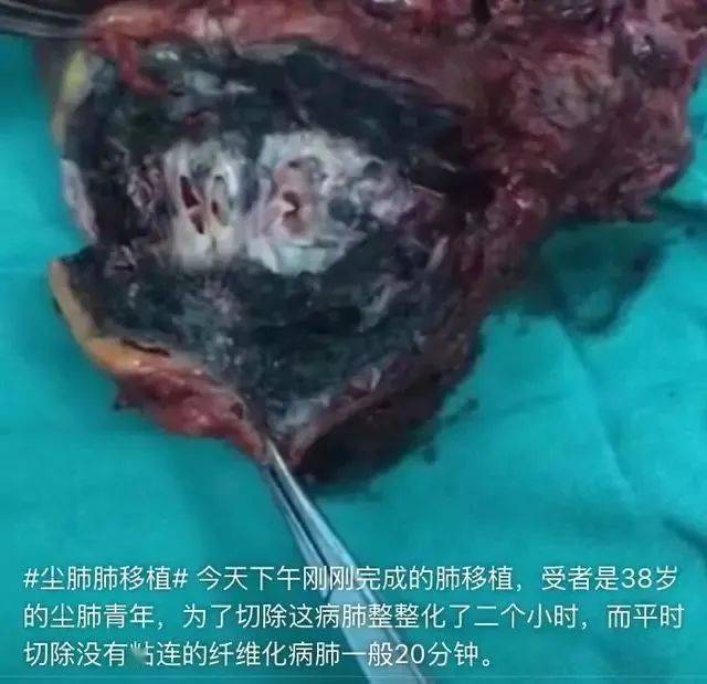 这种“无法呼吸的痛”,背后都是生活的沉重
