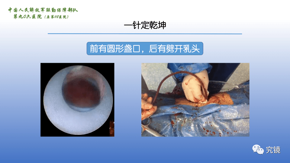思考系列||重新审视穿刺_乳头