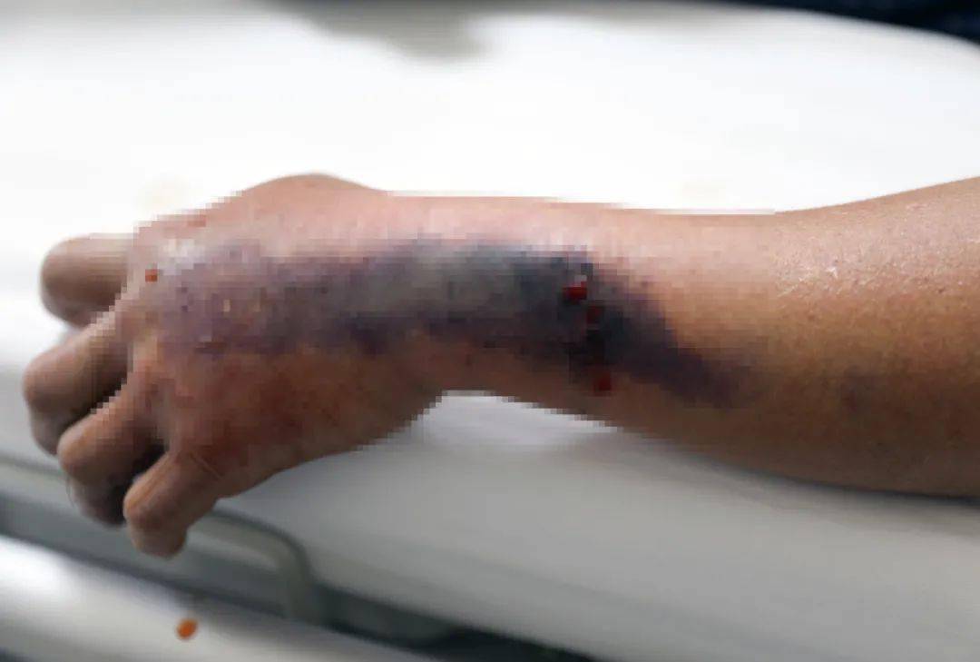 五一前后这东西出没柳州,咬一口严重可致命!_毒蛇