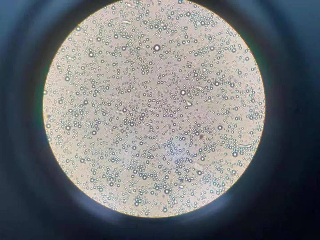 母乳检测质量不佳我还要继续母乳喂养吗