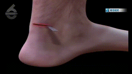 5d2dbd6fcee14cdc812a8d57854fca46.gif