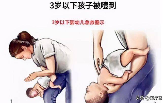 什么是海姆立克急救法自己怎么做 77552b1b1cd04ce7b6b518962d911aab.jpeg