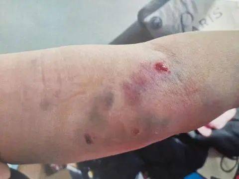 大狗咬伤居民咬死小狗!受害者索赔10万元!