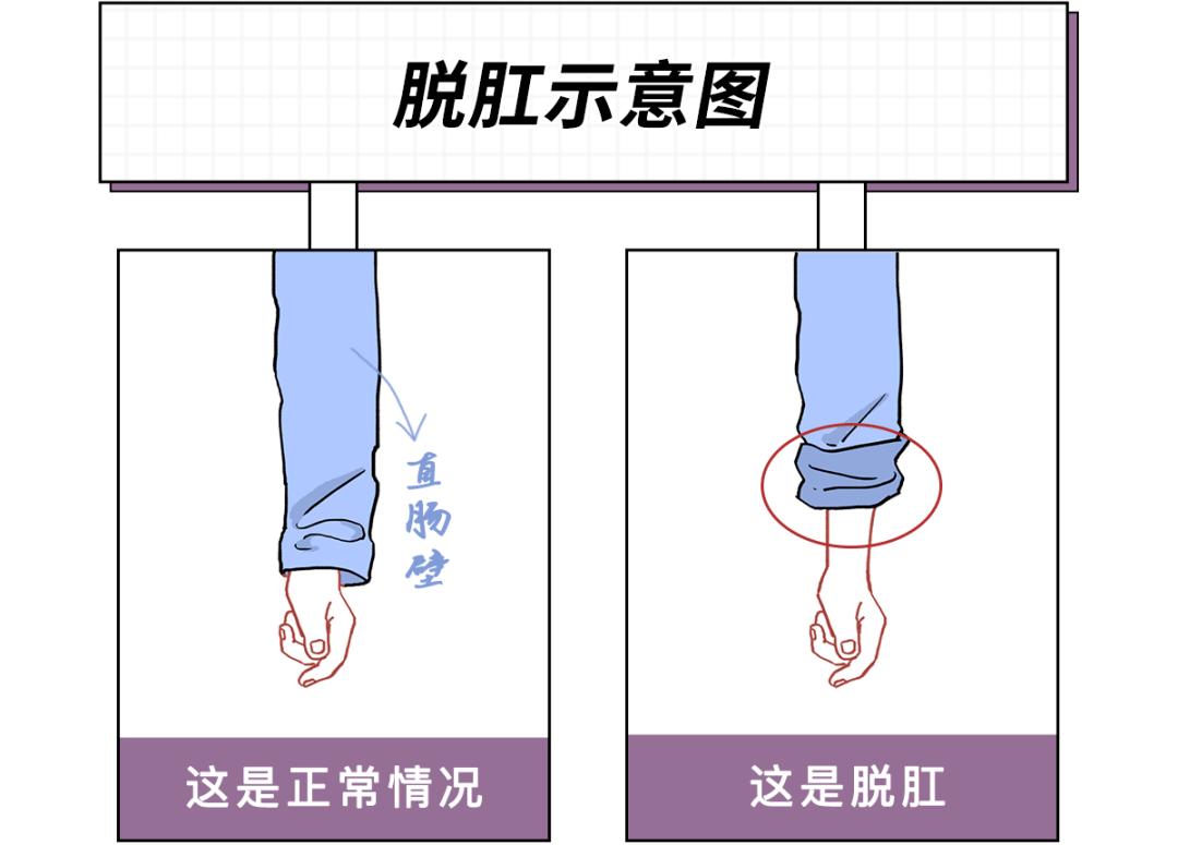 画了个形象生动的示意图我让萌萌给你们就已经充满了恐惧好么你听听