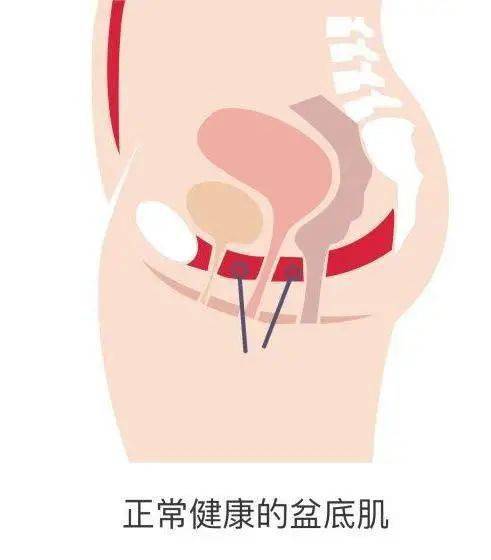 产后修复前先深度了解骨盆和盆底肌