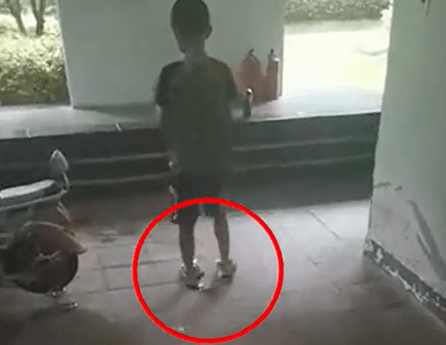 心疼小男孩戴脚镣在小区内游荡腿上伤痕累累邻居曾多次报警