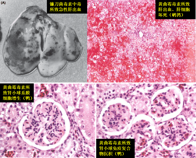 干货分享 | 小心"肝"又破了?