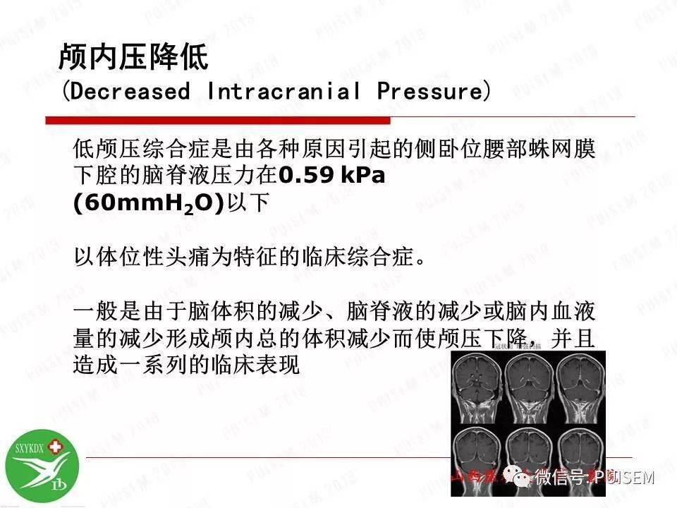 【ppt】颅内压的监测与管理