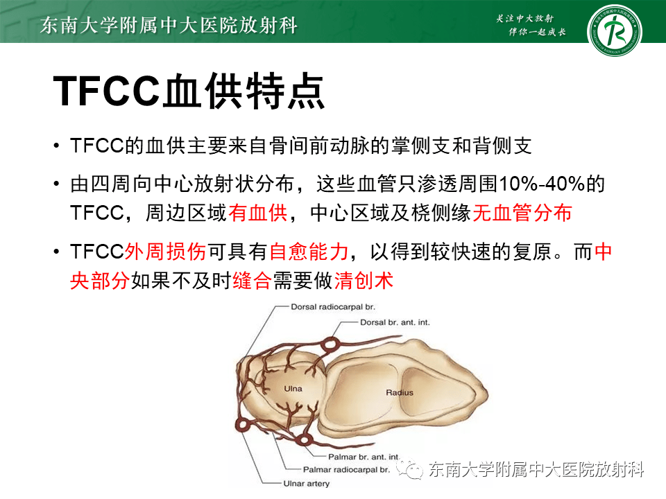 tfcc解剖及创伤性损伤