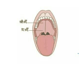 人口腔上颚示意图图片