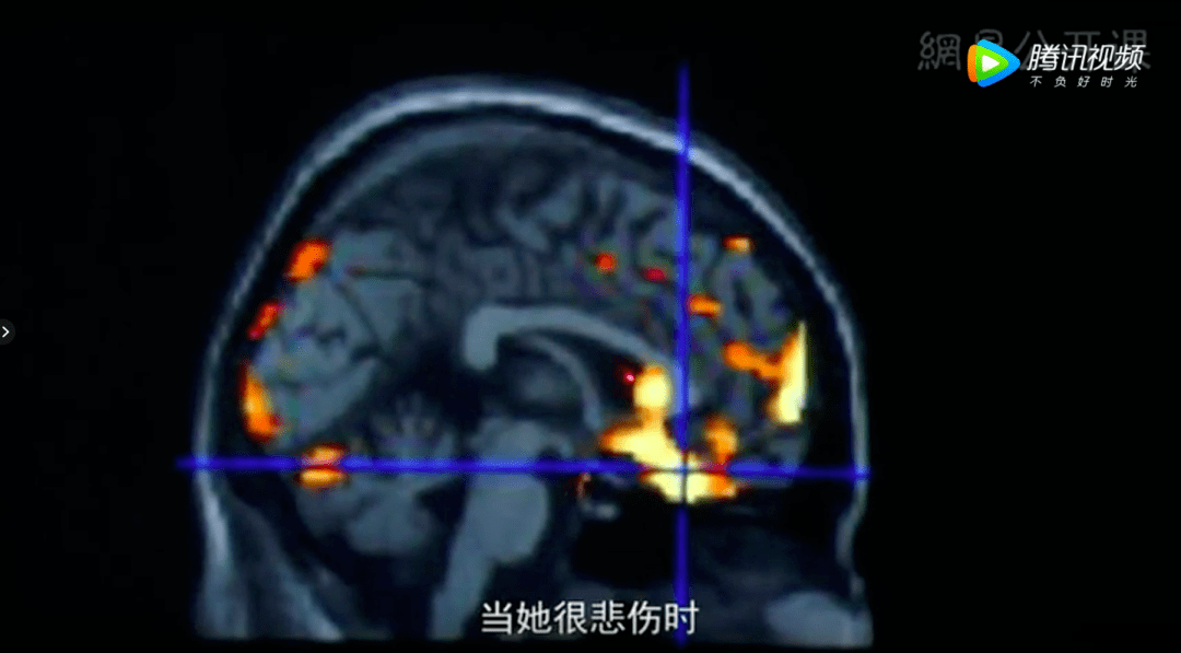 什么可以降低雄激素 720ef9d6c06e4979bfd58b440bf9d66d.png