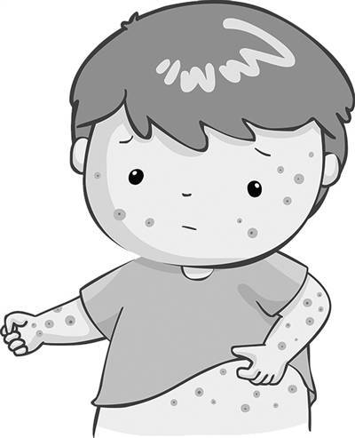 六岁男孩得"怪病",夜夜奇痒难忍