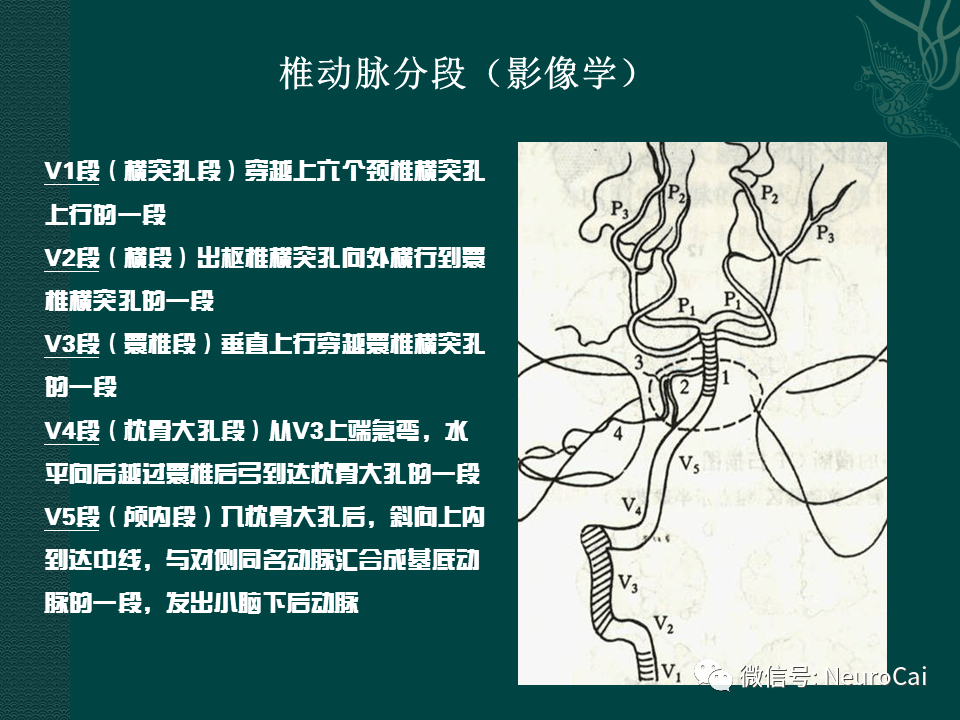 高清圖腦動脈解剖與ct重建