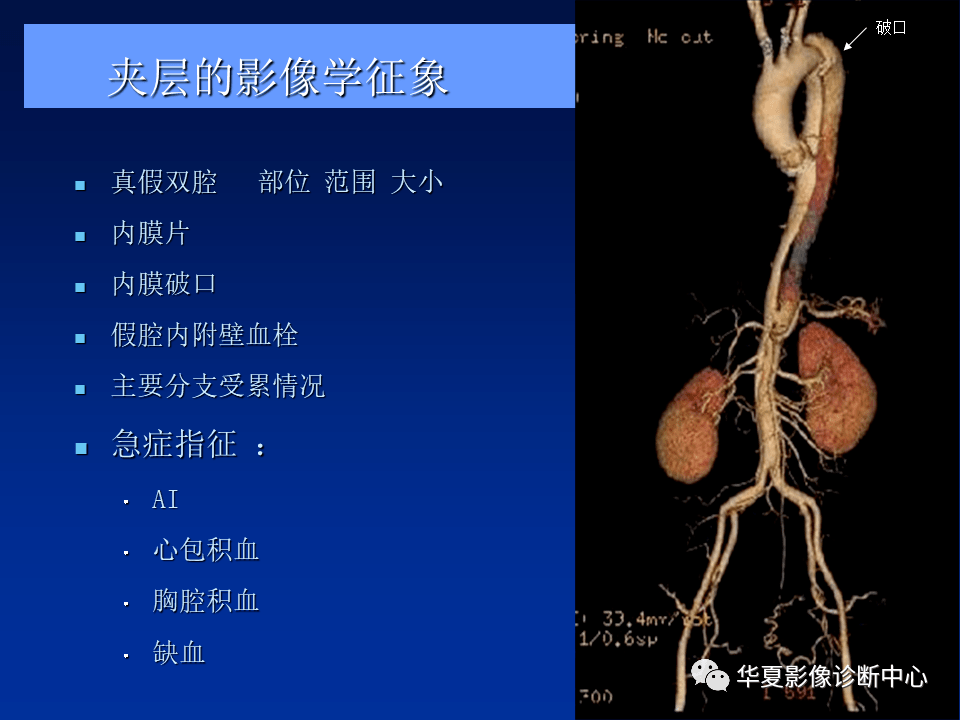 主動脈夾層,壁間血腫及穿通性潰瘍_診斷