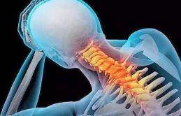 枕头|“挂树”疗法“治”好颈椎病？