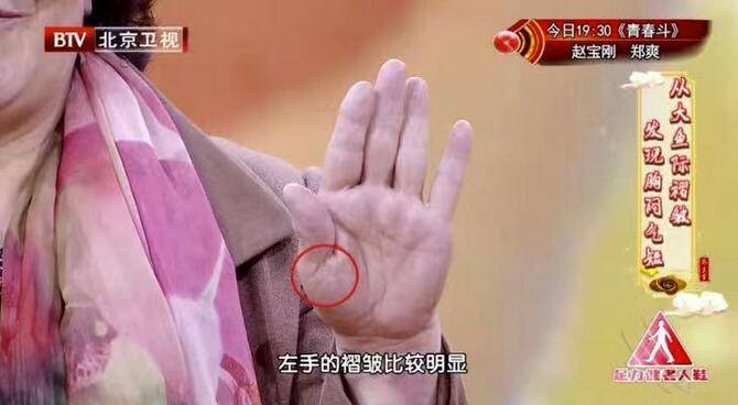 疾病|你的肺还好吗？抓住肺部异常的早期信号