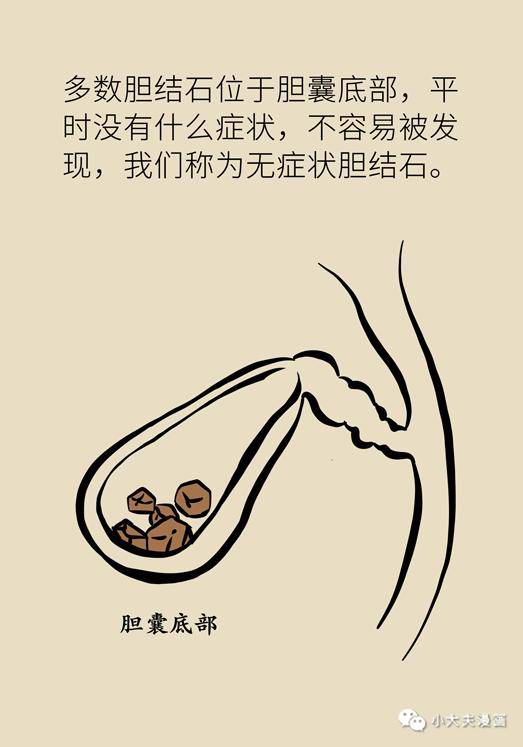 胆汁|不是谣言，长期不吃早饭，真有可能得这种病