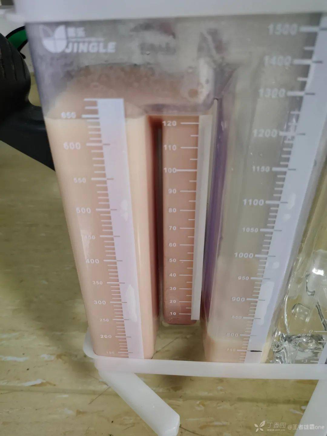 61 岁男性外伤后右侧流出「牛奶」胸水,病因竟是?_乳糜