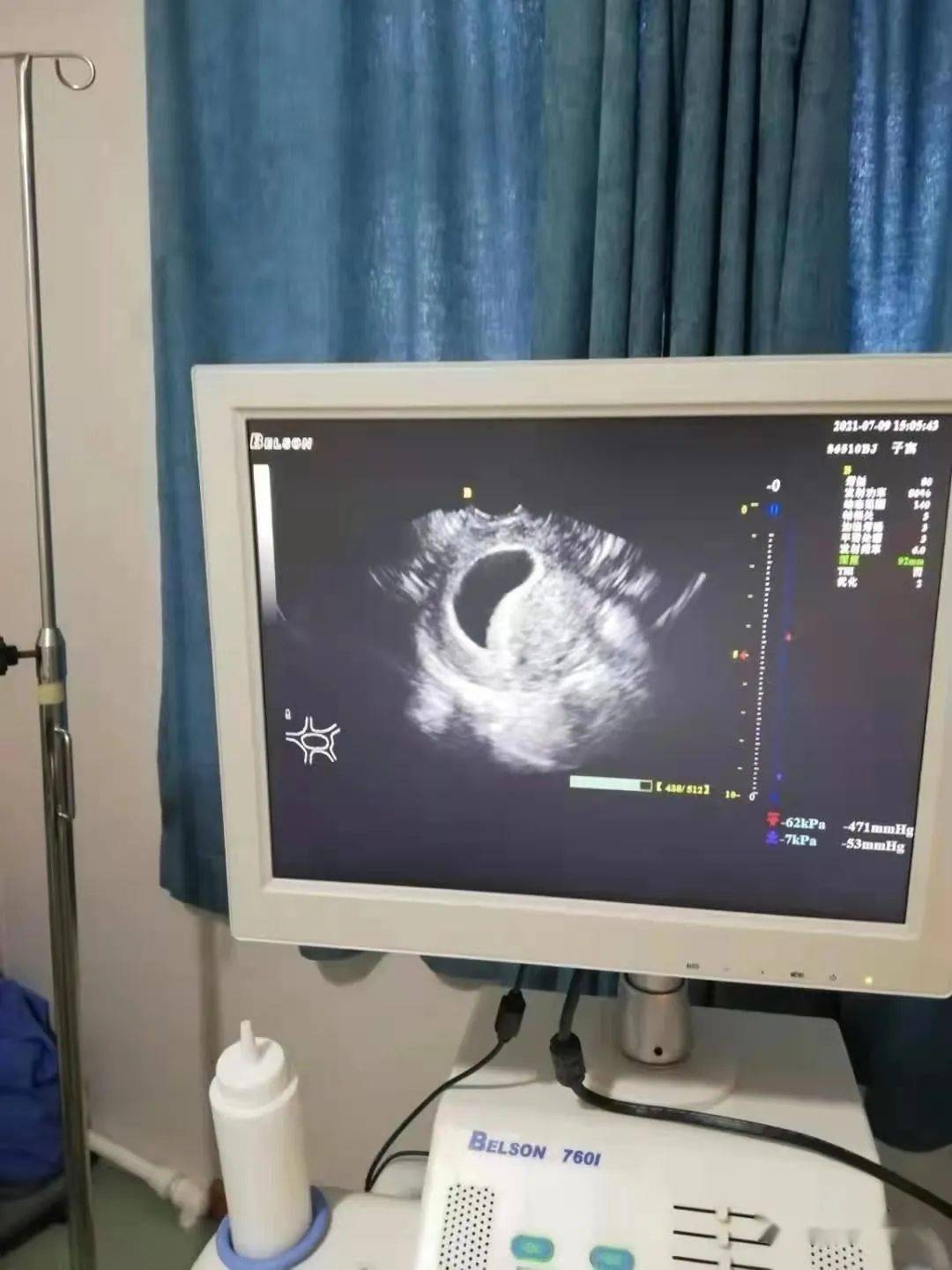 敦化市中医院带给女性的又一份关爱可视人流术