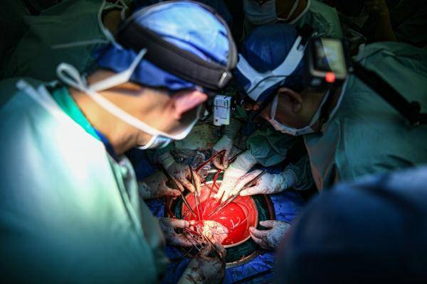 肺动脉|全球首例！中山一院成功开展“无缺血”心脏移植