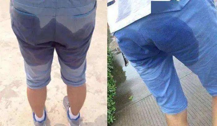 设计|每到夏天多少男人的愿望是“胯下生风”?