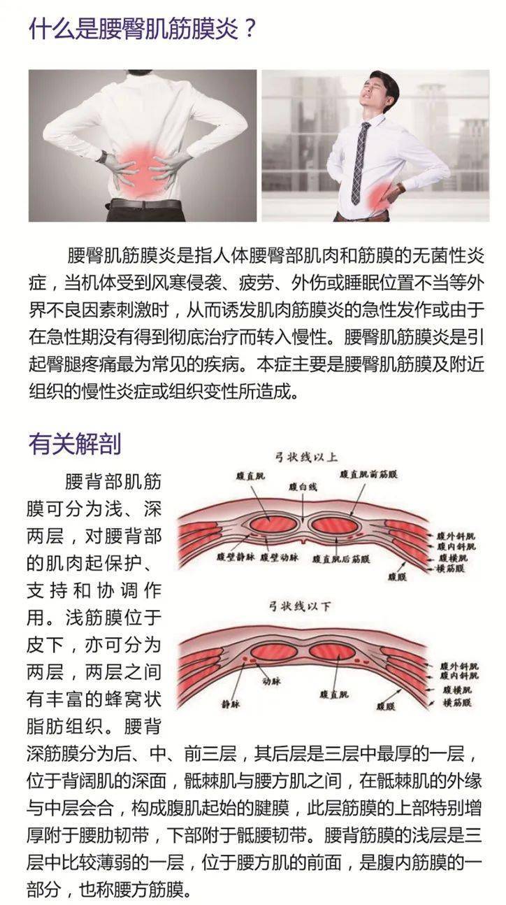 疼痛疾病科普腰臀肌筋膜炎