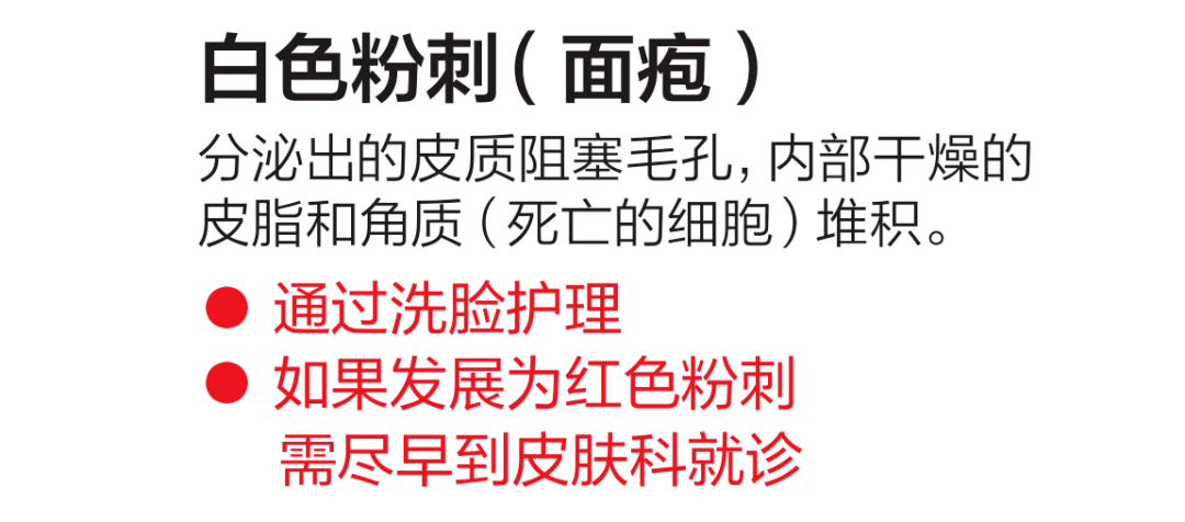 治疗|刘雨昕遮痘磨皮，尹净汉用痘痘贴，对抗粉刺你还需要这些！