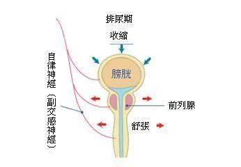 急性尿潴留丨欲排尿而不得,难受,该怎么预防?