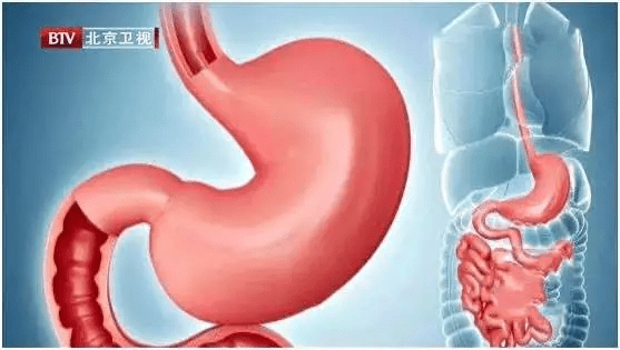 胃酸|“饭后百步走，活到九十九”？这些你深信不疑的健康俗语，究竟是真是假？别再被坑了……