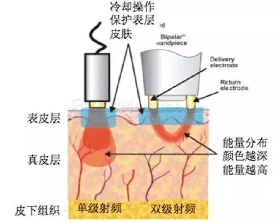 玛吉|孕期渣男出轨，导致终身不孕；终遇良人，老公却又死于意外，她太惨了