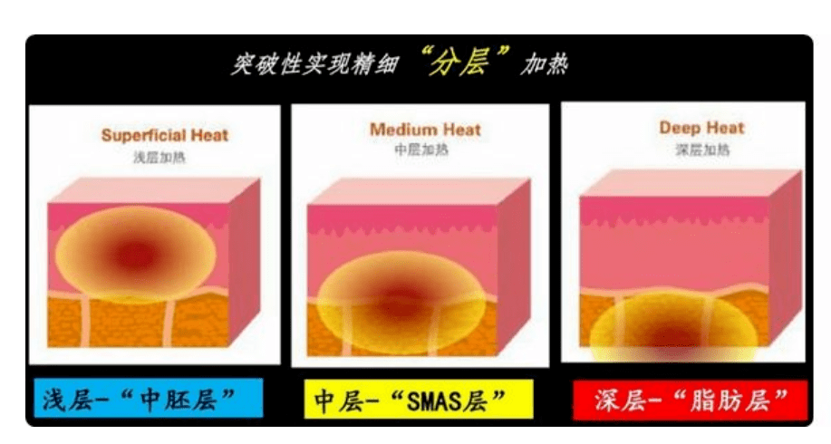 玛吉|孕期渣男出轨，导致终身不孕；终遇良人，老公却又死于意外，她太惨了