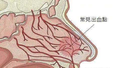 鼻子毛细血管明显图片图片