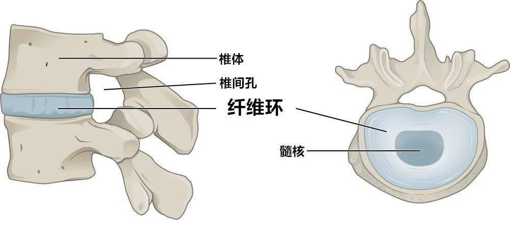 首先椎間盤的定義,椎間盤指的是一塊纖維軟骨在兩個椎體之間,在兩個