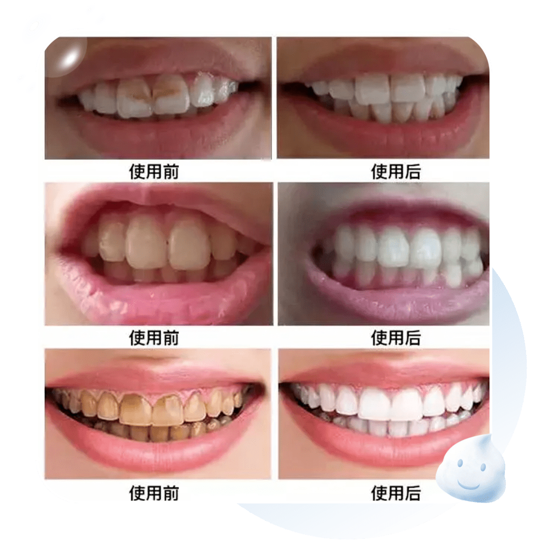 就能看到牙齿变得又白又亮