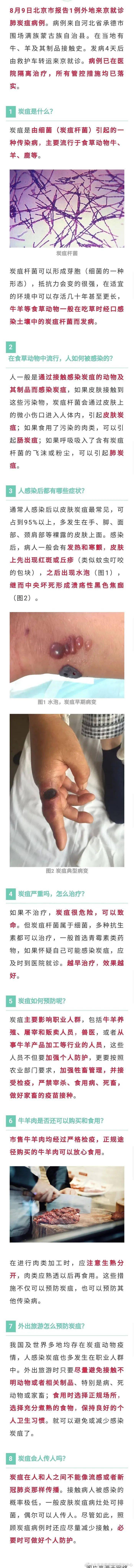 疫情|北京报告1例肺炭疽病例，已在医院隔离治疗