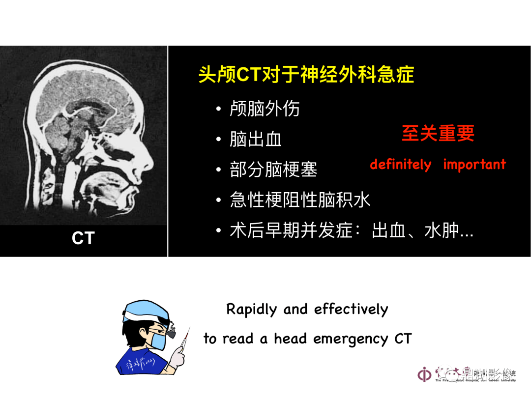 头颅侧面图片