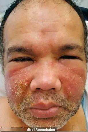 重磅!中国疫苗或将在澳获批!维州新增20例,解封基本凉了!