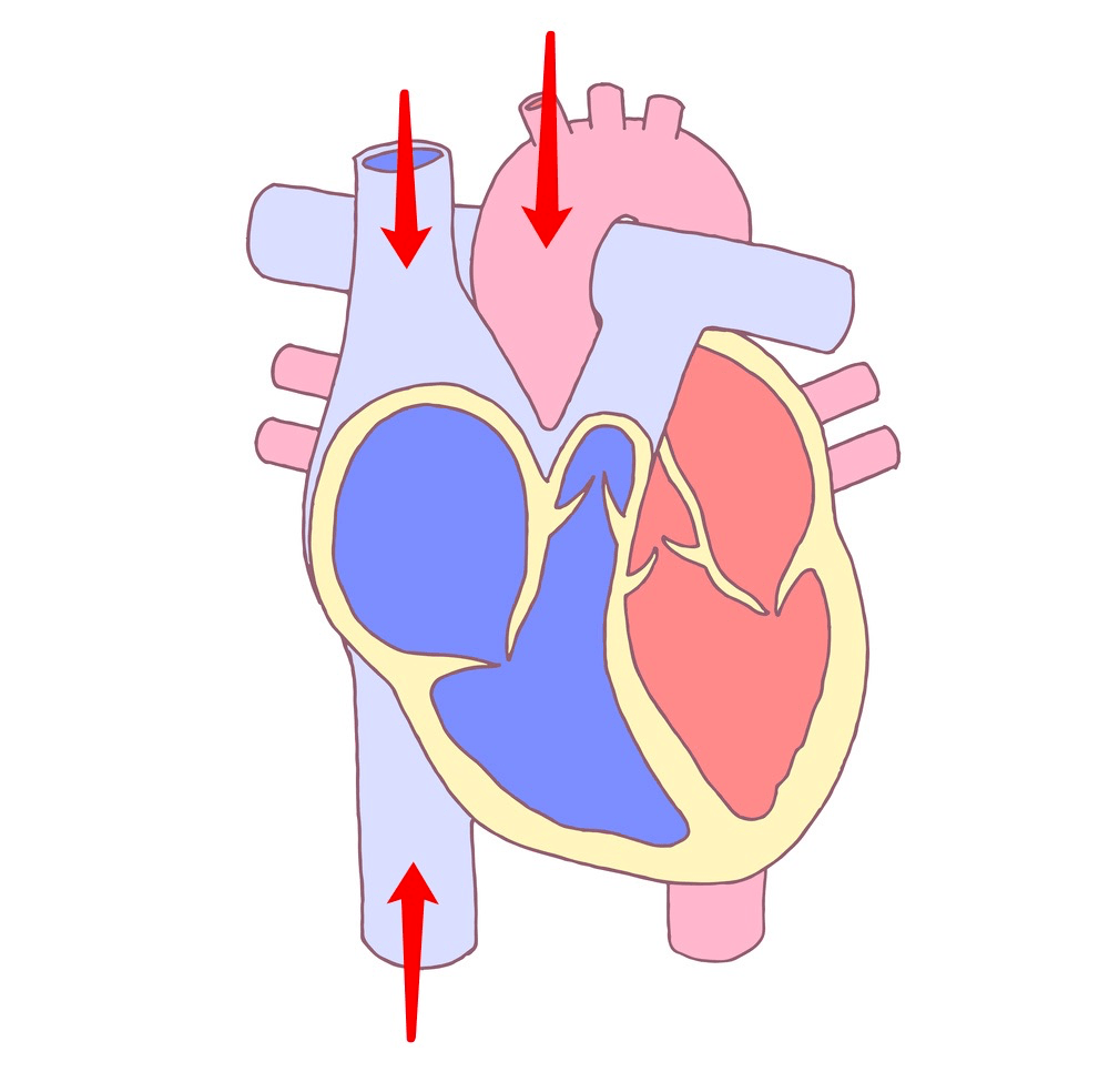 心臟,逆流而上