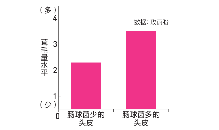 假发|周洁琼拆下5个假发片，保持头皮健康是美发的关键！