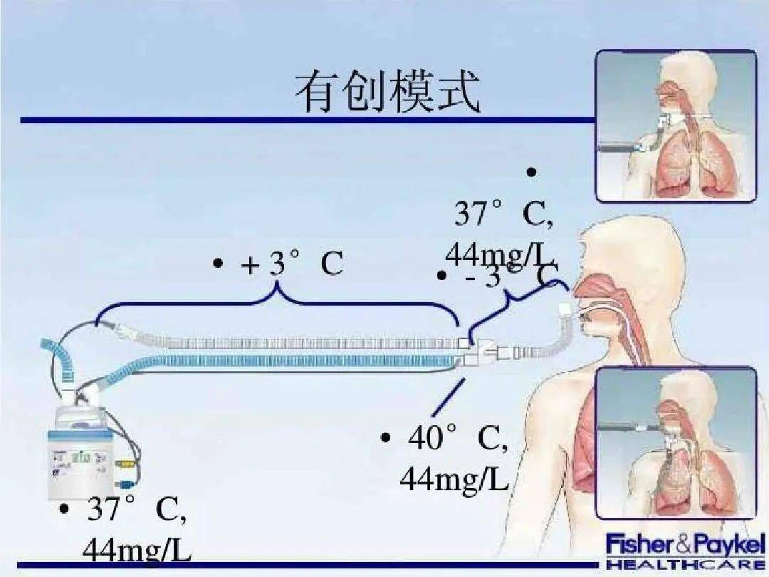 气管切开气囊放气图解图片