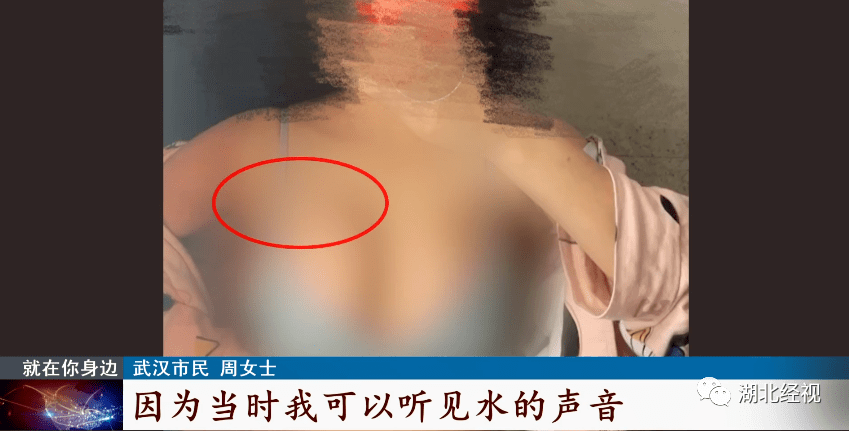 因为|武汉女子隆胸后崩溃：“胸长到肩膀下面了”！医美机构称主刀医生不是医院的