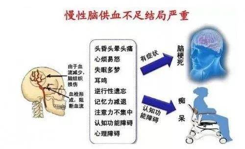 生活|经常头晕乏力，充分休息还没减轻，警惕脑供血不足，防治重点在这