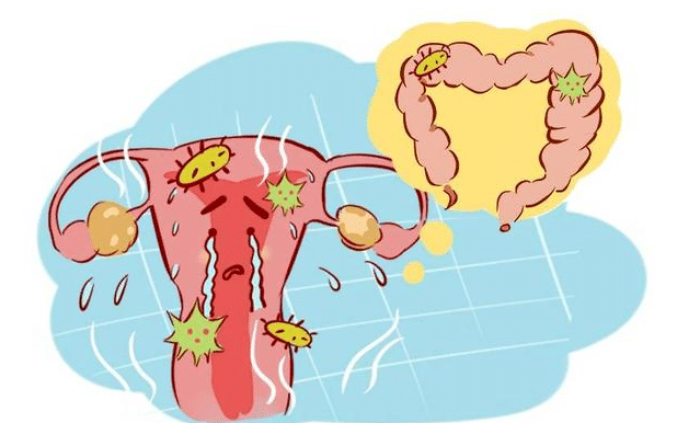 子宫内膜癌腹痛位置图图片