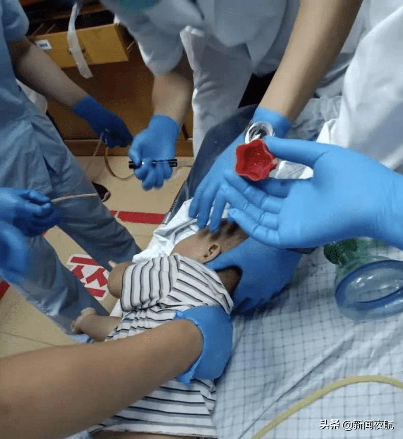 气道|又是它！4岁孩童以为是糖，一口气吞下26颗