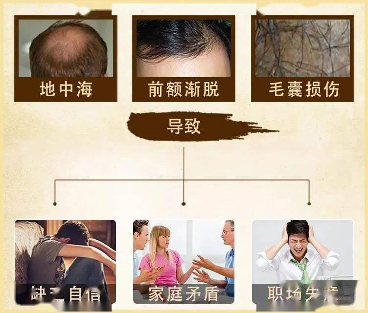 洗头|脱发，又丑又显老！教你一招，头发浓密，更显年轻好气质