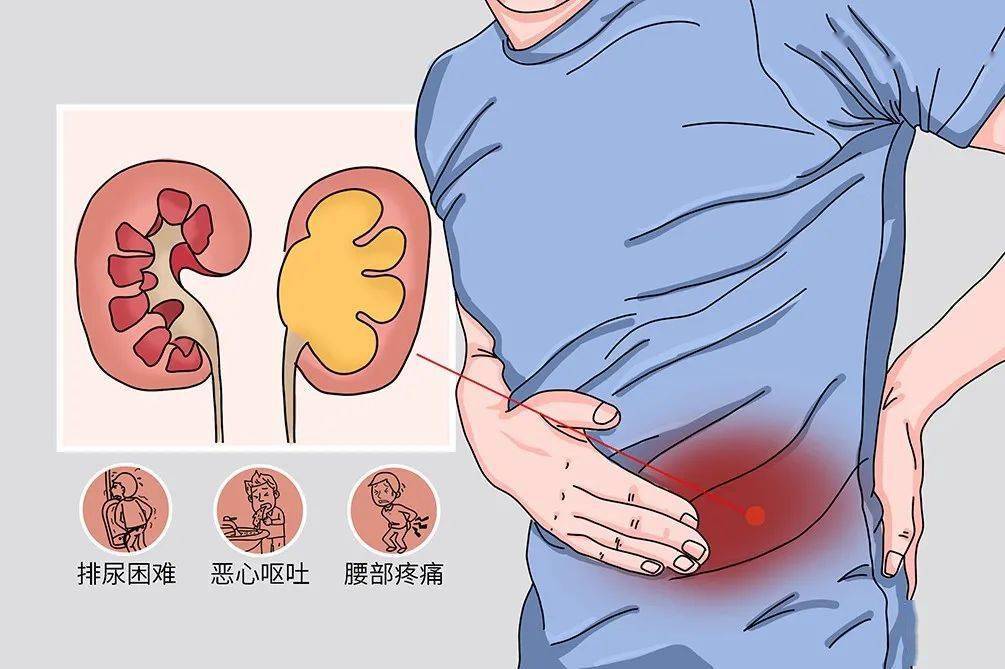 天津中医药大学第二附属医院帮扶医生进行疑难病例会诊