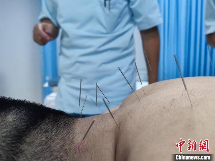 交流|六旬日本归侨回成都开诊所：中医针灸需要国际间交流合作