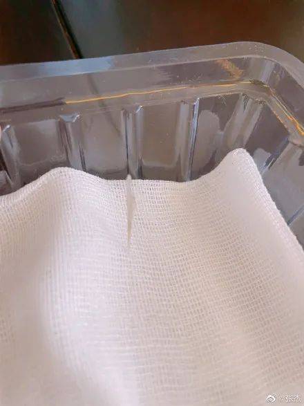 张杰|知名男歌手连夜麻醉做……很多人都遇到过