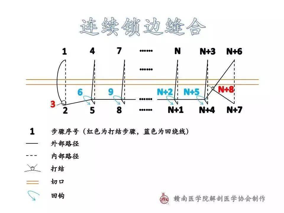 血管吻合缝合方法图片