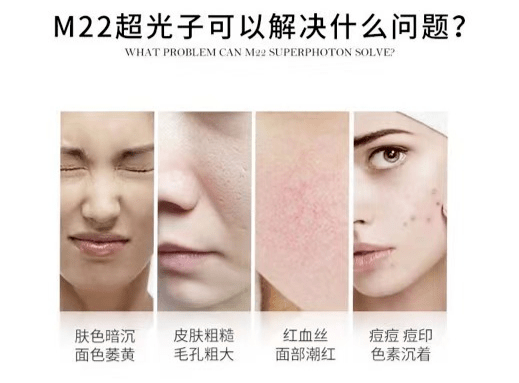玛吉|研究了四大港圈顶流美人，终于得到这份苏州小娘鱼“护肤图鉴”